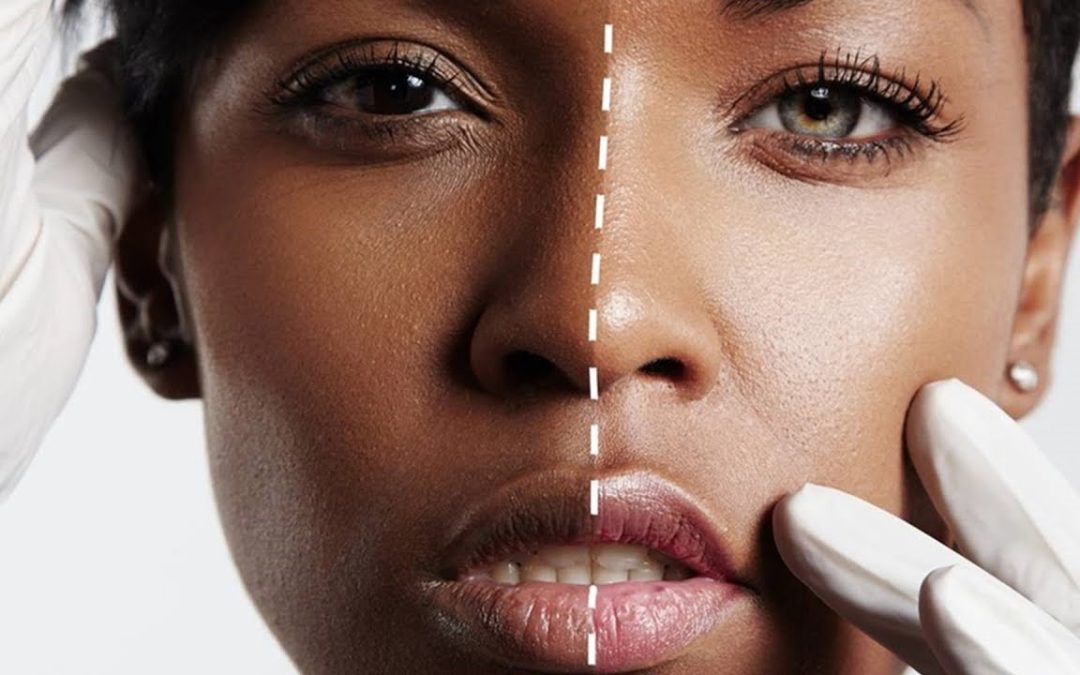 A Simple Guide to Bleaching Near Me in Singapore